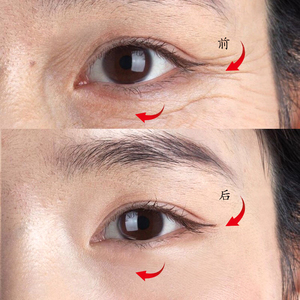 鱼尾纹贴提拉紧致去眼角纹眼贴膜抗皱抗初老鱼尾纹神器男女士正品