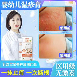 湿疹膏抑菌霜止痒婴儿痱子干性疹宝宝口水奶藓红屁屁药膏146人付款28