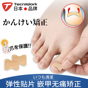 日本正甲贴嵌甲矫正器脚趾甲长肉里甲沟炎正甲贴指甲指沟神器贴片