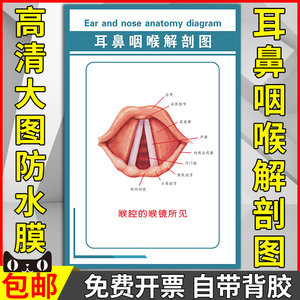 耳鼻咽喉解剖图墙贴纸海报喉腔的喉镜所见示意图医院人体器官挂图
