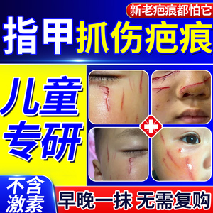 指甲抓伤疤痕祛疤膏儿童专用小孩去疤膏抓痕修复脸部去除淡疤痕QY