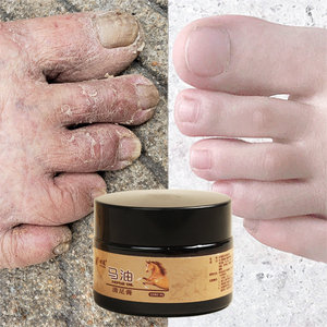 脚气克星 手脚干裂 一抹即恢复 嫩滑肌肤 男女通用 防冻足霜 爆赞