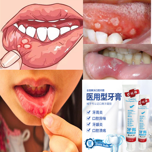 牙周炎牙膏医用口腔溃疡治疗牙龈萎缩出血松动修复再生牙齿脱敏药