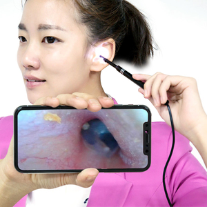 成人耳屎专业器耳朵掏神器耳可视挖耳勺淘掏器挖高清采耳工具