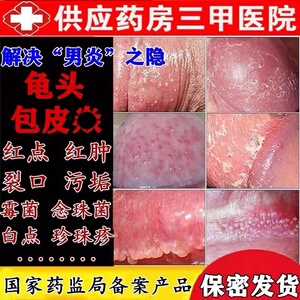 龟头包皮垢炎男士霉菌念珠菌私处异味阴茎裂口破皮瘙痒红点疼药膏