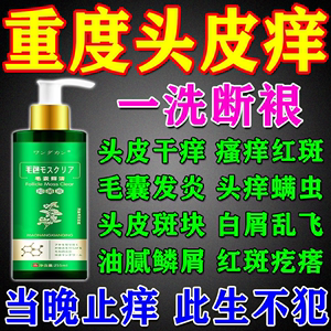日本进口头皮痒止痒膏脂溢性皮炎毛囊炎洗发水去屑止痒疙瘩抑菌液