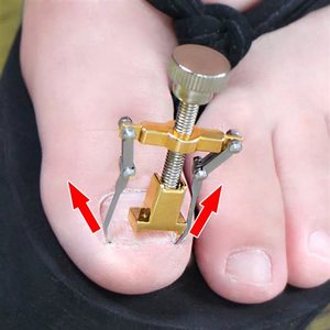 指甲修正器矫正