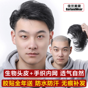 假发头顶补发片地中海真发男士短发生物头皮补发蓬松隐形前额发块