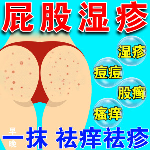 屁股湿疹股藓大腿内侧专用止痒肛门瘙痒宝宝湿疹皮肤疱疹抑菌药膏