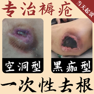 褥疮膏老人去腐特效生肌膏促进伤口愈合药老烂腿压疮臀部外用糖尿
