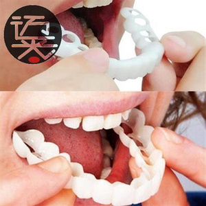 洁白牙套