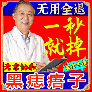 点痣祛痣的药膏点痣膏无痕正品点痦子去黑痣肉痣祛斑脸部专用神器