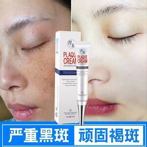 氢醌霜祛斑霜祛雀斑祛黄褐斑淡斑乳膏分解黑色素黑斑晒斑爆款