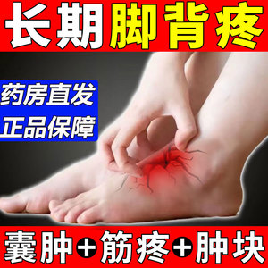 脚背筋膜炎疼痛脚面脚踝腱鞘囊肿贴鼓包肿痛扭伤治疗专用膏药贴zt