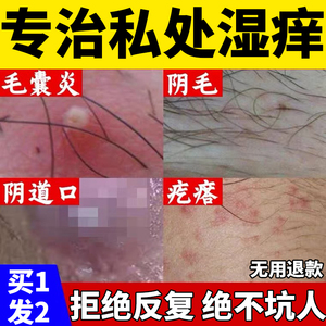 外阴瘙痒止痒女性专用下面药膏去阴毛痒根毛囊炎白斑湿疹私处抑菌