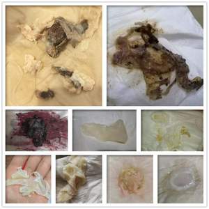 清宫丸正品排毒拉线套盒妇科私部栓剂中药云南本草凤保宁凝胶官网