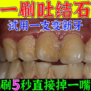 【一口净去除牙结石牙膏】一口净去除牙结石牙膏品牌,价格 - 阿里巴巴