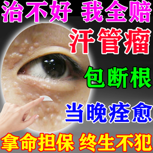 汗管瘤眼部去除神器脂肪粒眼周黑眼圈暗沉点扁平疣日本专用药水膏