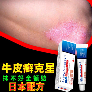 xianshengfeng0702淘宝香皂头藓除螨虫克星阴囊湿疹专治牛皮癣外用
