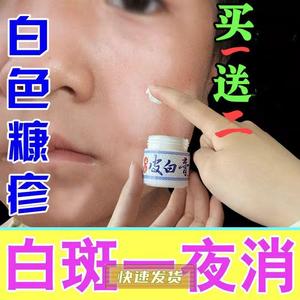 正品【买一送二】儿童成人白色糠疹药膏脸上白斑长癣鳞屑单纯糠疹