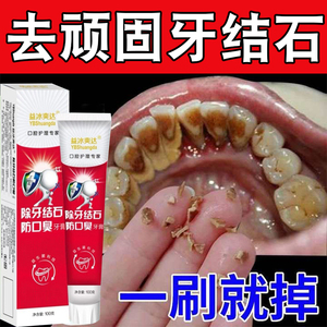 一口净去除牙结石牙膏