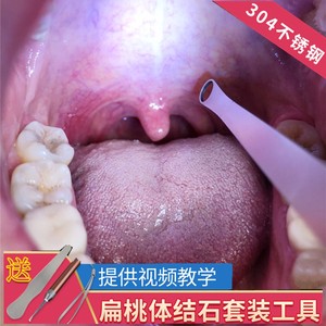 吸扁桃体结石的工具