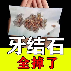 去黄口臭牙结石美白牙膏去黄牙结石牙齿美白去烟渍牙膏脱色去除剂
