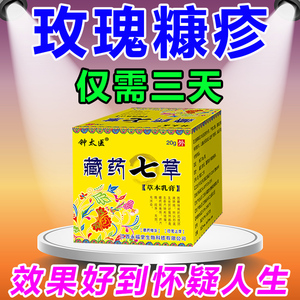玫瑰糠疹专用药膏紫外线晒伤过敏日光性皮炎湿疹外用止痒皮肤瘙痒