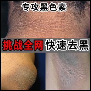 告别脖子黝黑后面黑黑的黑棘皮去除症腋下关节膝盖手肘去黑磨砂膏