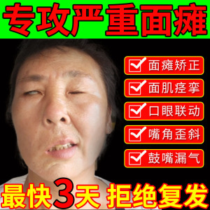 牵正膏治口眼联动面瘫贴后遗症按摩热敷神器恢复面肌痉挛贴7人付款68