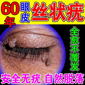 丝状疣眼皮去猴子肉粒疙瘩专用药眼睛面部脖子扁平疣瘊子去除神器