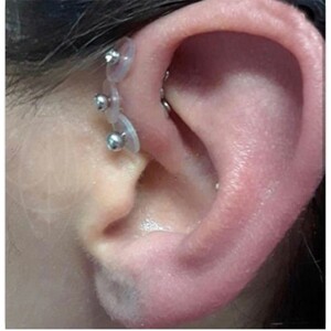 耳洞小飞碟防增生唇钉耳骨防增生小飞盘耳堵耳洞防增生消除息肉