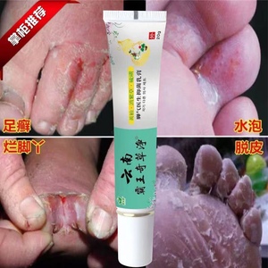 去脚气水泡强效止痒根治真菌感染脱皮脚趾缝烂脚丫瘙痒无刺激套装