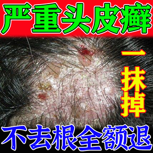 0071人付款淘宝治疗毛囊炎身上皮囊炎手臂腿上前胸后背脸硬疙瘩背部
