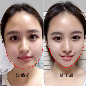 网红推荐v脸神器~大脸克星秒变瓜子脸~脸大不求人男女通用买3送1