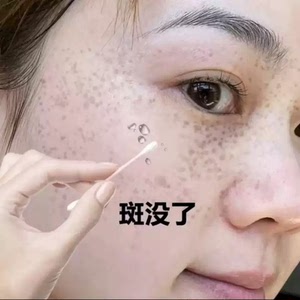 96同款货源独角兽i1淘宝李佳琪推荐 去脸上一切黑点 斑点 除去