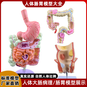 人体大肠结肠结构解剖病理痔疮展示十二指肠胃消化道系统教学模型