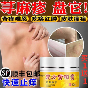 荨麻疹过敏止痒断根专用膏治疗慢急风团性胆碱能性划痕性皮肤药膏