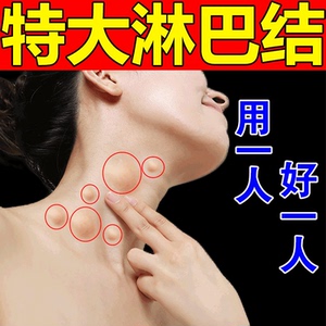 【当晚见效】淋巴结肿大散结贴膏疏通颈部腋下淋巴结节肿大疼痛膏