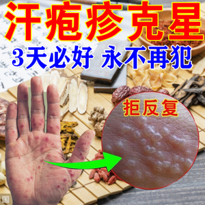 004人付款淘宝兰孚真菌清霜2支乳膏手指皮肤痒开裂脱皮止痒脚趾头缝隙