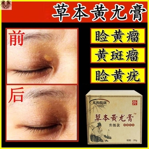 去除睑黄疣药膏眼部祛黄色瘤圆脸黄斑黄睑瘤康脸部睑黄瘤膏专用膏