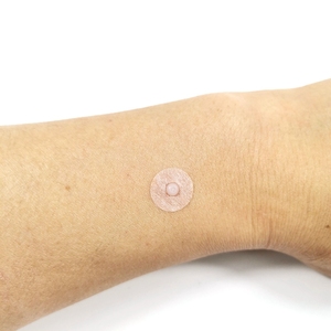 揿针医院同款皮内针无菌揿针美容耳穴儿童体穴无痛埋针贴穴位针贴