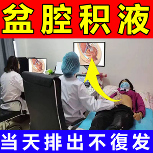 盆腔积液热敷包