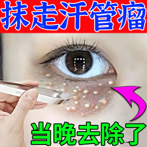 治疗汗管瘤眼部专用药膏去除眼周脂肪粒去平疣油脂粒非针脸黄疣膏