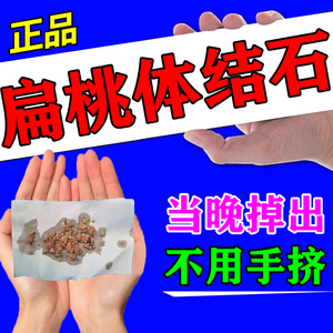 扁桃体结石去除工具非漱口水隐窝冲洗器清理咽喉肿痛口腔发炎喷雾