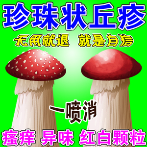 80200人付款天猫明康欣 阿达帕林凝胶10g/盒寻常痤疮 粉刺 丘疹 脓疱