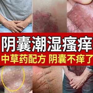 男科念珠菌包皮龟頭炎珍珠疹囊瘙痒私处止痒红点肿裂口消炎药膏