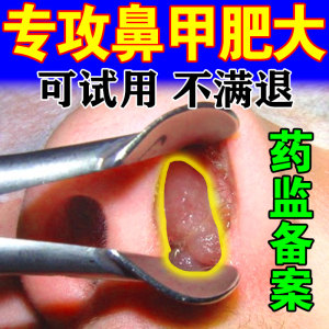 鼻甲肥大鼻息肉专用药膏治过敏性鼻炎喷雾剂日本脱落鼻塞通鼻神器