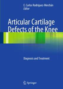 实体书articular cartilage defects of the knee diagnosis and