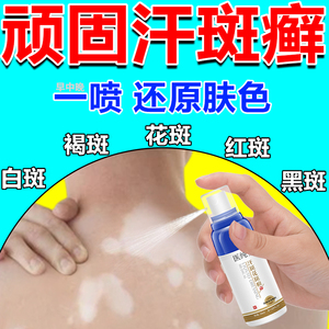 益康唑喷雾剂治疗脚气膏喷剂脱皮止痒杀菌去脚臭真菌感染923人付款31